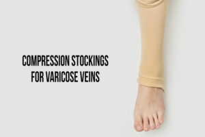 pressure for varicose veins