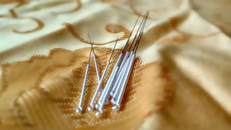 Fatty liver-acupuncture