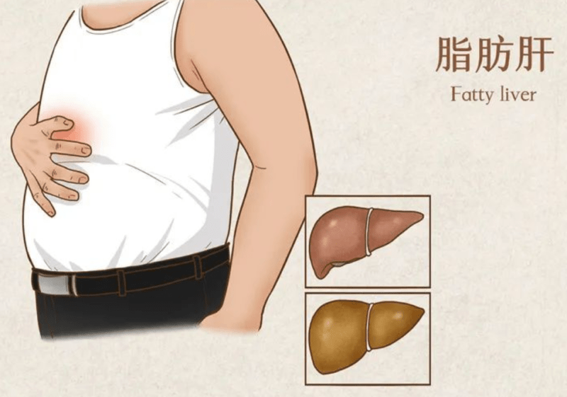 Fatty liver vs liver