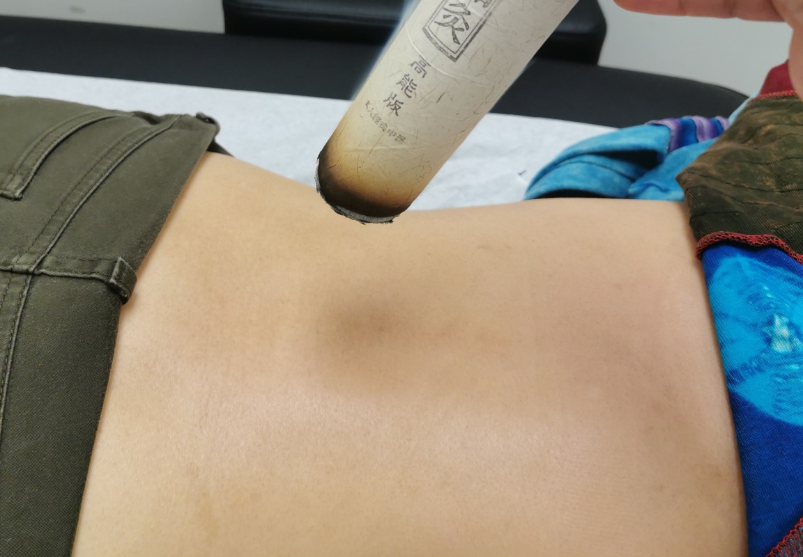 Safe moxibustion technique demonstration showing distance from skin for heat therapy